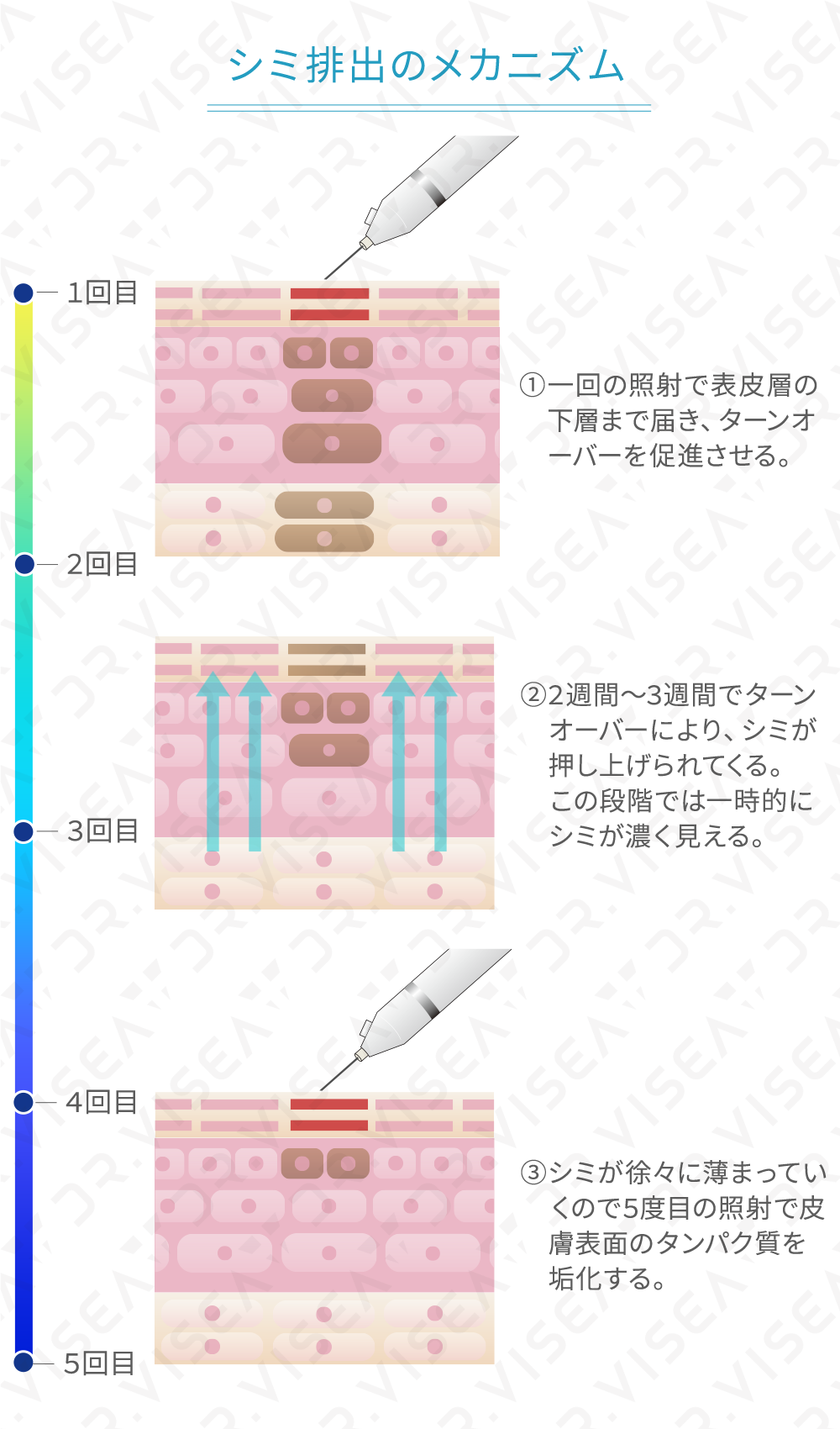 Cenbless　成増フェイシャル＆ネイルサロン　プラズマフェイシャル-シミプラズマプロ効果画像