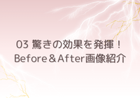 Cenbless　成増フェイシャル＆ネイルサロン　シミプラズマネオ-03 驚きの効果を発揮！Before＆After画像紹介