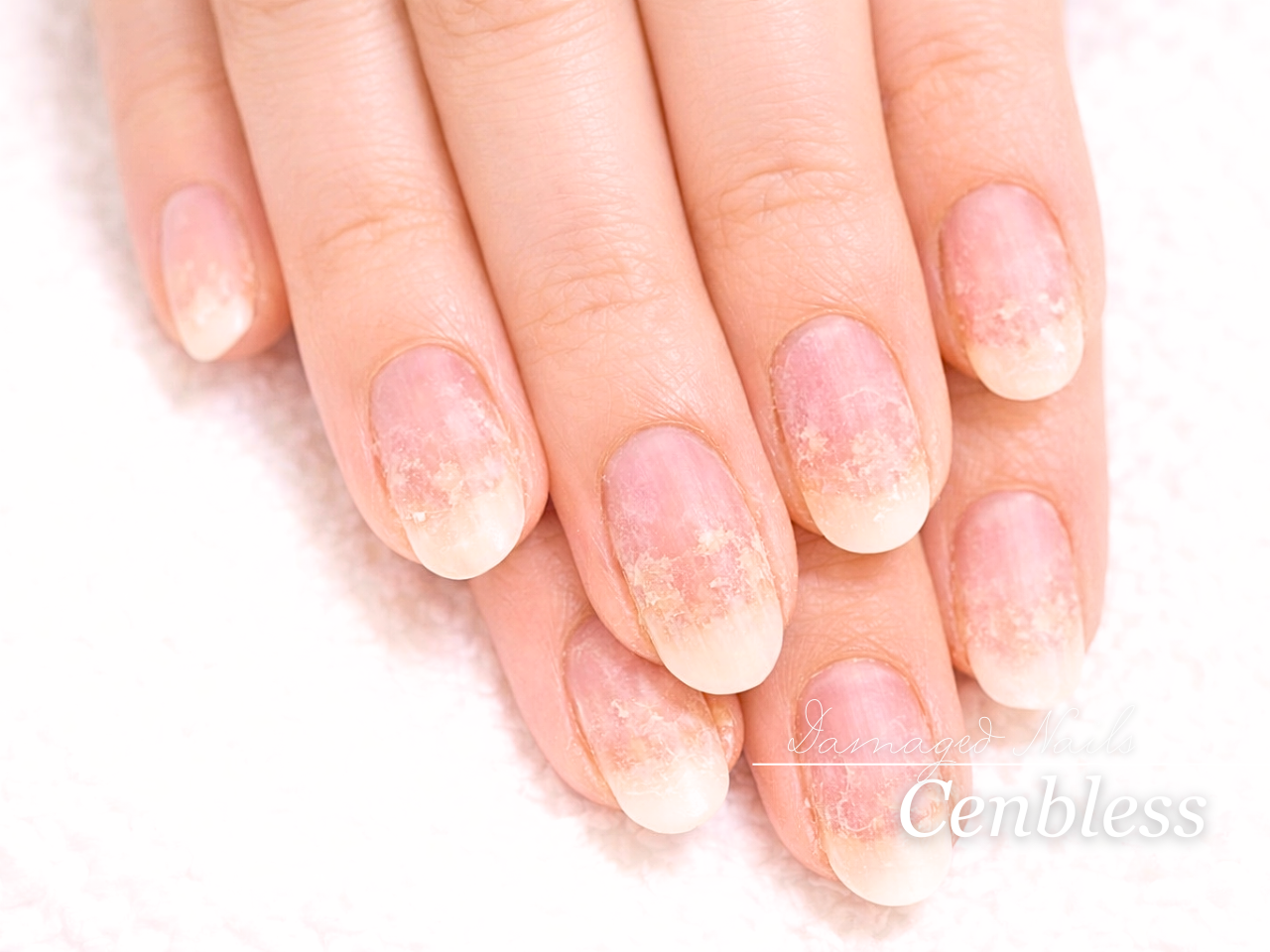 Cenbless　成増フェイシャル＆ネイルサロン　フィルインとは？自爪を大切にしたい方へ